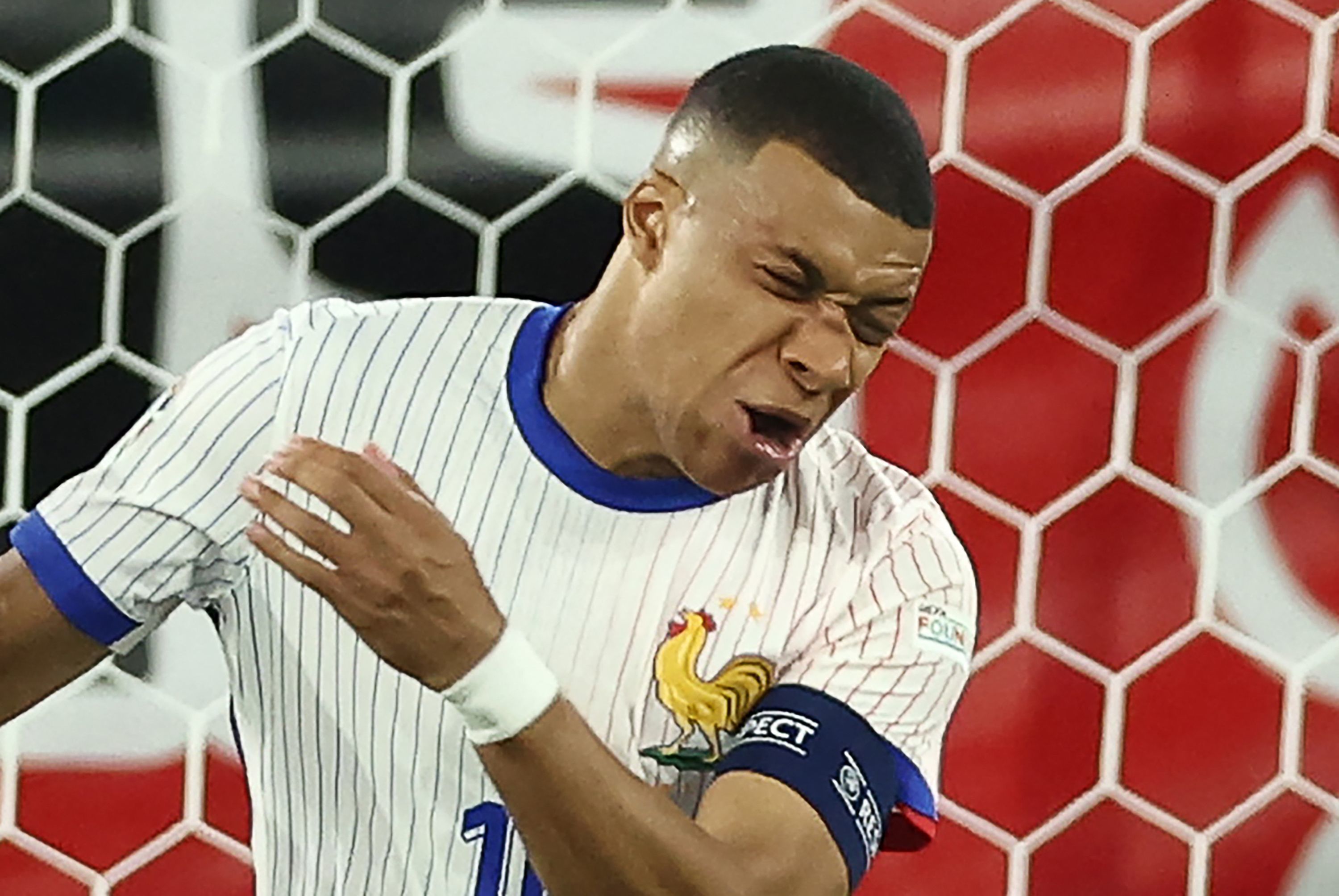 Kylian Mbappé, tras ser herido en el partido de Dusseldorf.