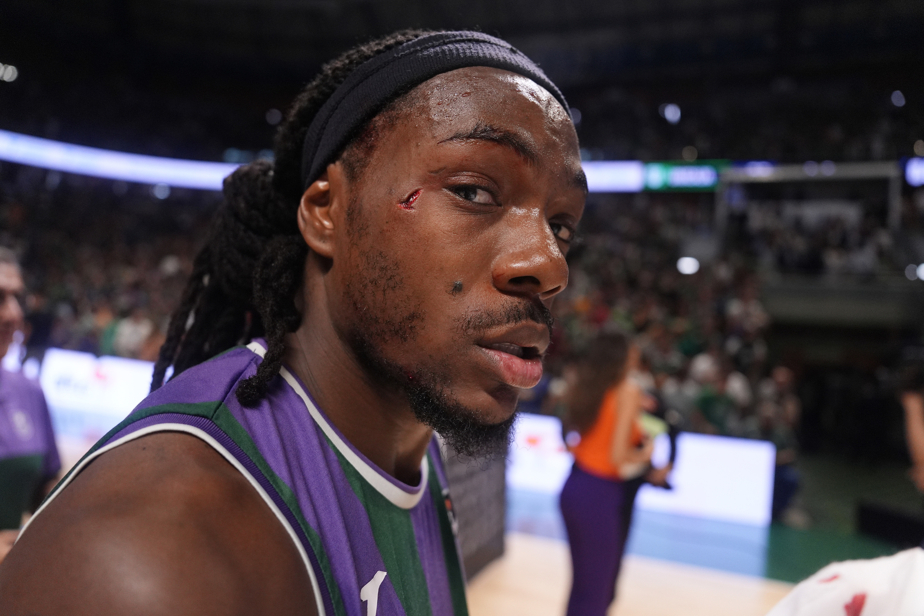 El rostro de Perry, tras el codazo de Musa.