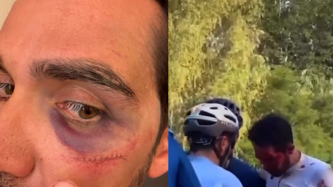 Alberto Contador sufre una aparatosa caÃ­da en el DesafÃ­o China de La Vuelta en PekÃ­n: "Con puntitos y algÃºn diente menos"