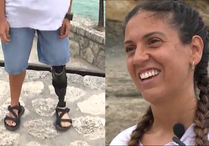 La surfista paralímpica Mireia Cabañés recupera su pie ortopédico perdido en el mar gracias a sus seguidores