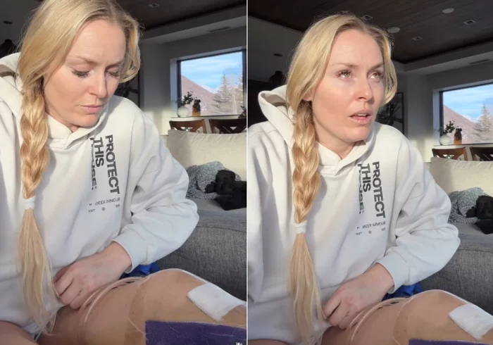 La dramática confesión de Lindsey Vonn: "Mi médico me salvó de que me amputaran la pierna"
