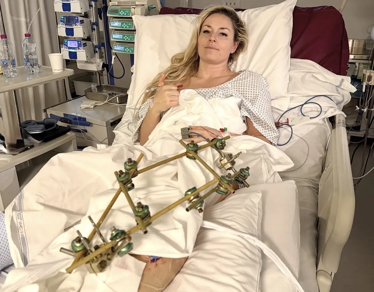 Lindsey Vonn será operada por cuarta vez en Italia antes de "volver a casa"